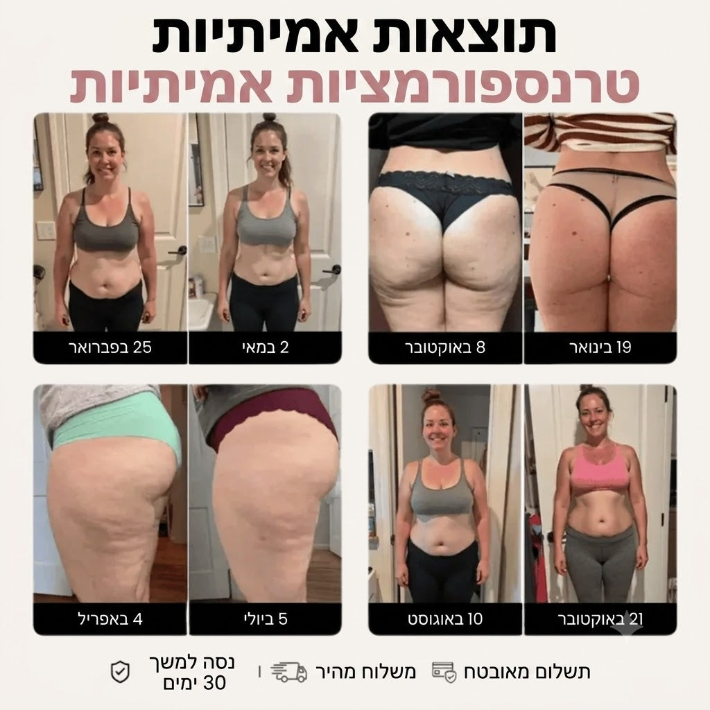 טייץ