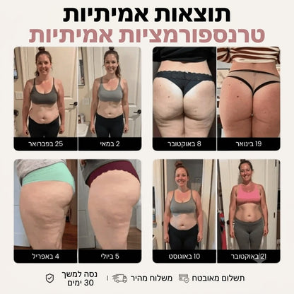 טייץ